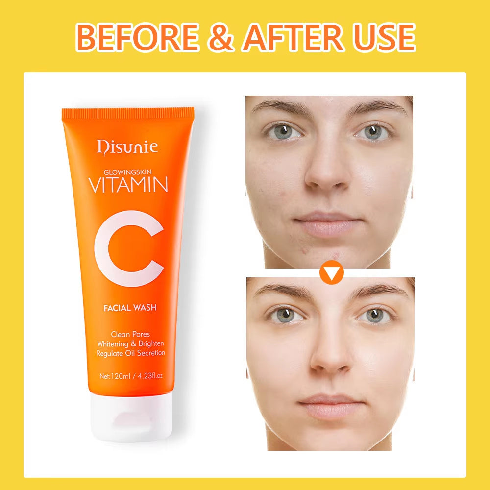 Vitamin C